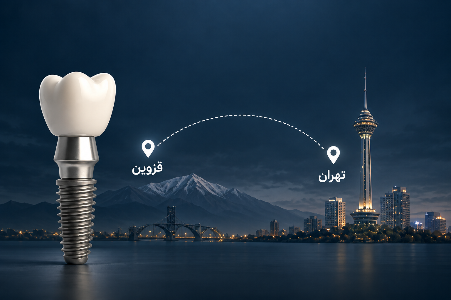 آیا برای لمینت دندان از قزوین به تهران مراجعه کنیم؟